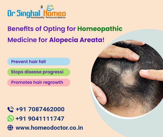 Get Effective Alopecia Areata Homeopathic Treatment at Dr. Singhal Homeo